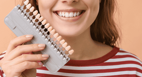do porcelain veneers stain
