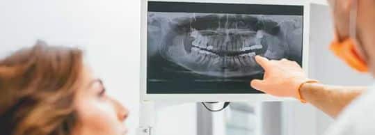 How Dental X-Rays Protect Oral Health?
